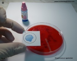 latex agglutination of group B streptococci